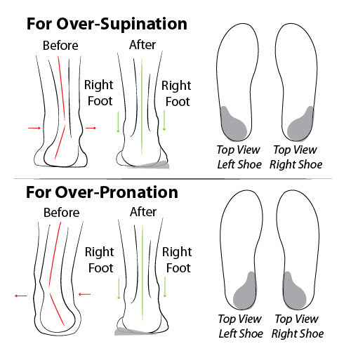 Heel Wedge  (Re-Usable, Adhesive)